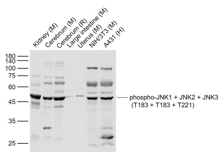 Anti-Phospho-JNK1/2/3 (Thr 183, 183,  221) Polyclonal Antibody