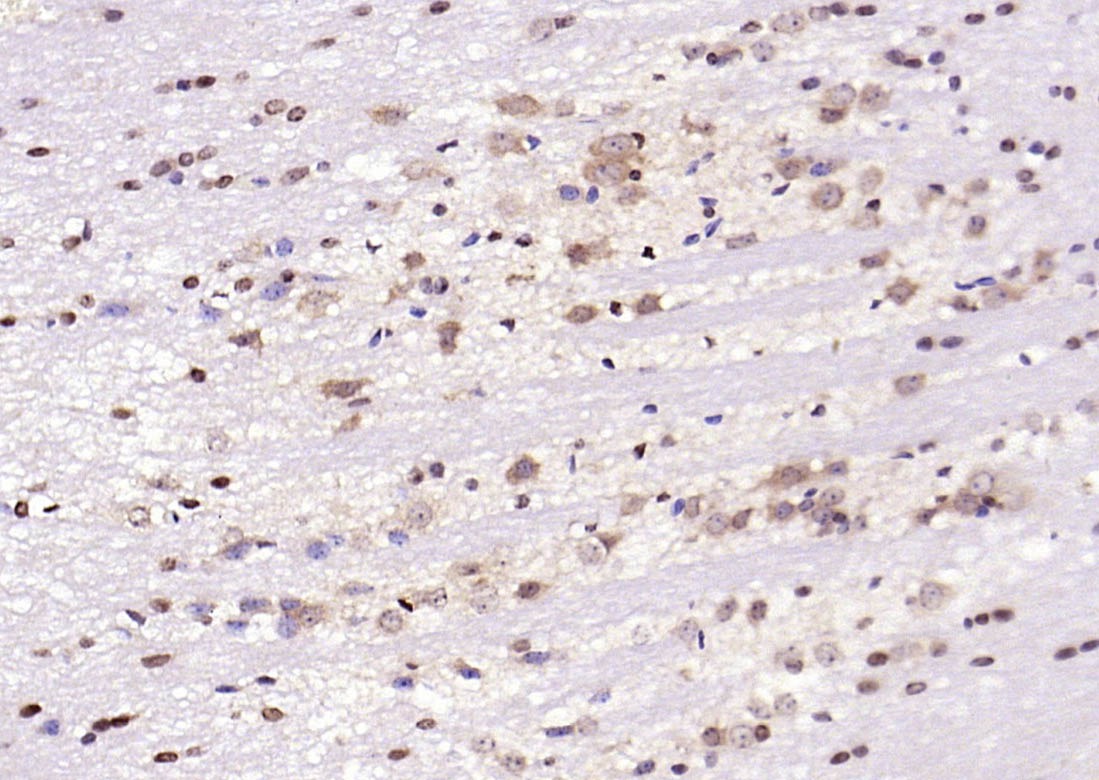Anti-Phospho-JNK1/2/3 (Thr 183, 183,  221) Polyclonal Antibody
