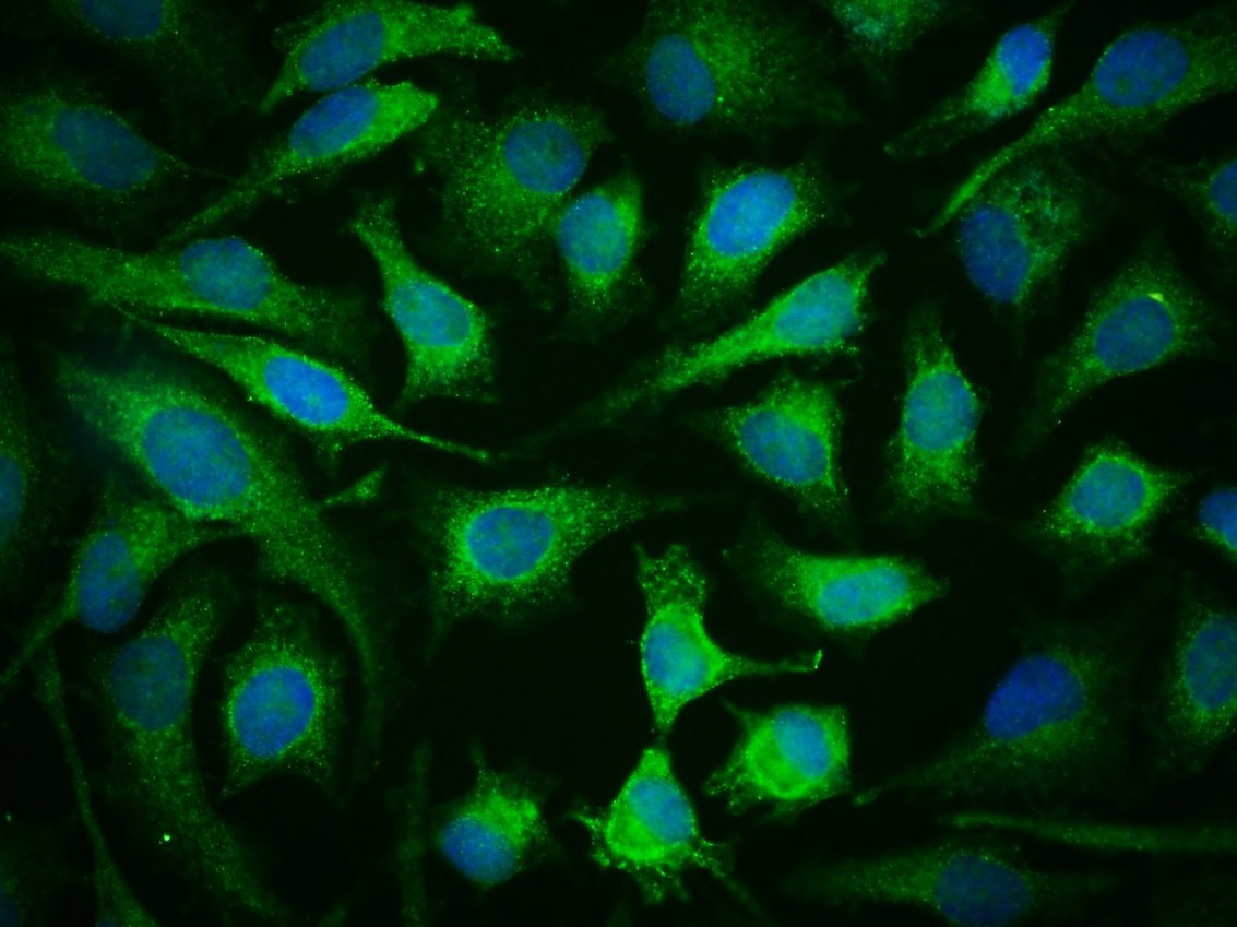 Anti-Phospho-JAK2 (Tyr1007, 1008) Polyclonal Antibody