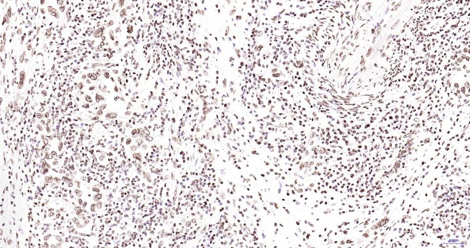 Anti-Phospho-JAK2 (Tyr1007, 1008) Antibody (2X102)