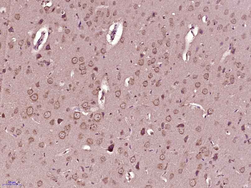 Anti-Phospho-Serine/Threonine Polyclonal Antibody