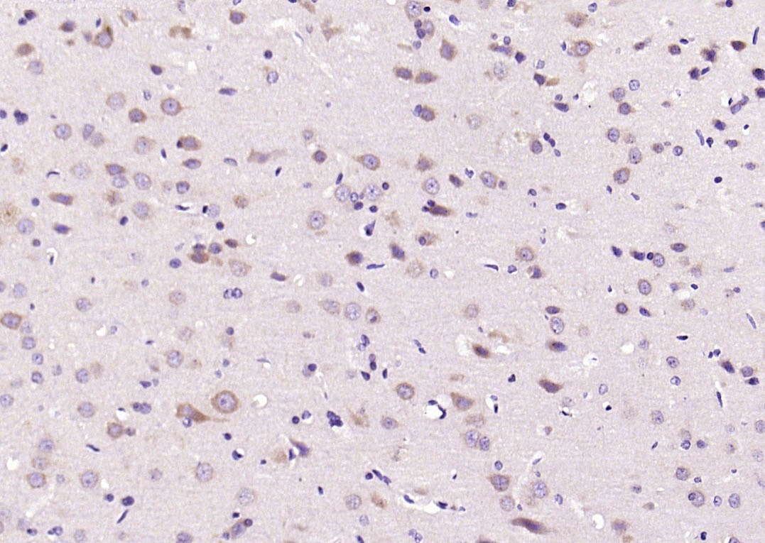 Anti-Phospho-JNK1/2/3 (Thr 183, Tyr185) Polyclonal Antibody