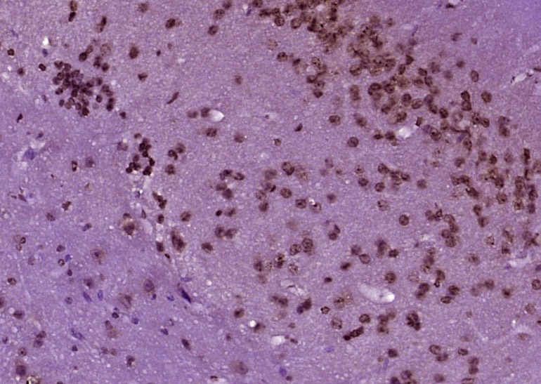 Anti-Phospho-Smad2 (Ser465, 467) Polyclonal Antibody