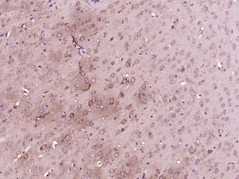 Anti-Phospho-Serine/Threonine Polyclonal Antibody