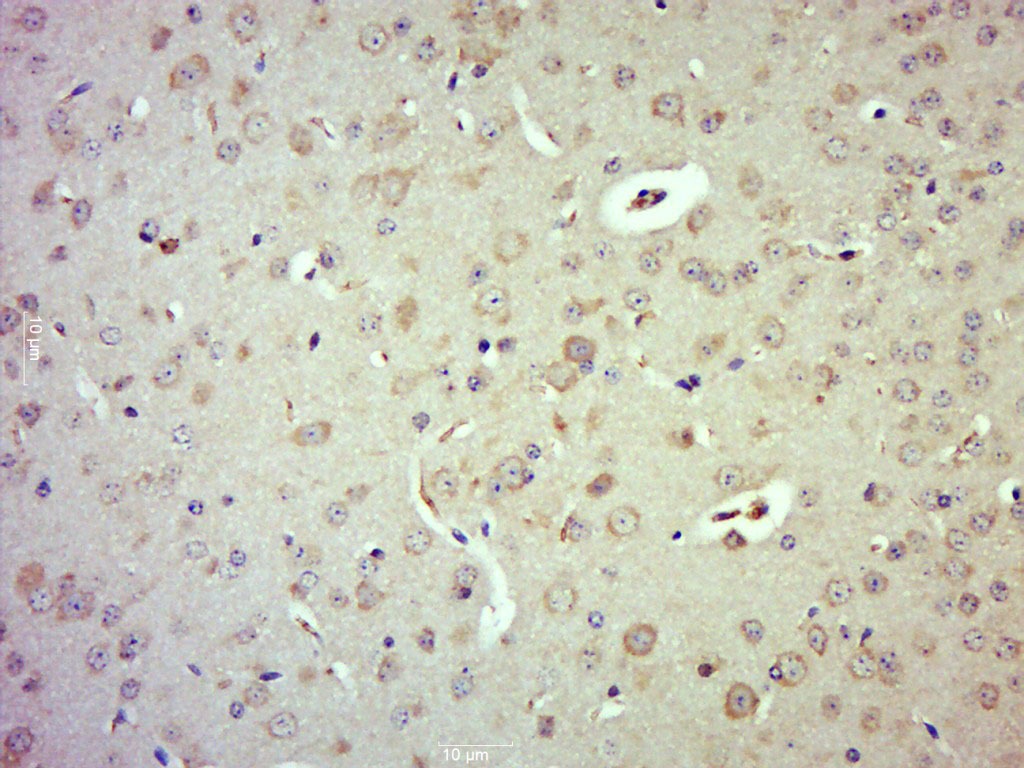 Anti-Phospho-LATS1/2 (Thr1079, 1041) Polyclonal Antibody
