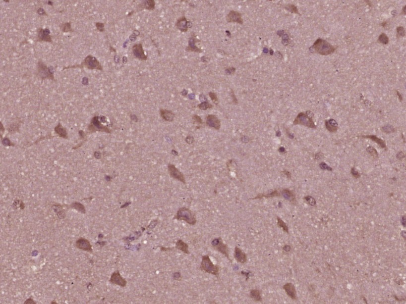 Anti-Phospho-JNK1/2/3 (Thr 183, Tyr185) Polyclonal Antibody