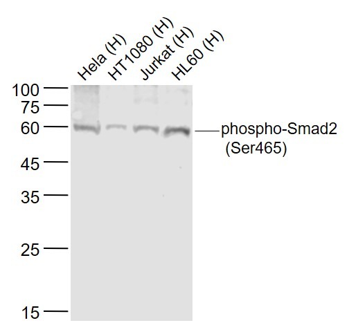 Anti-Phospho-Smad2 (Ser465) Polyclonal Antibody
