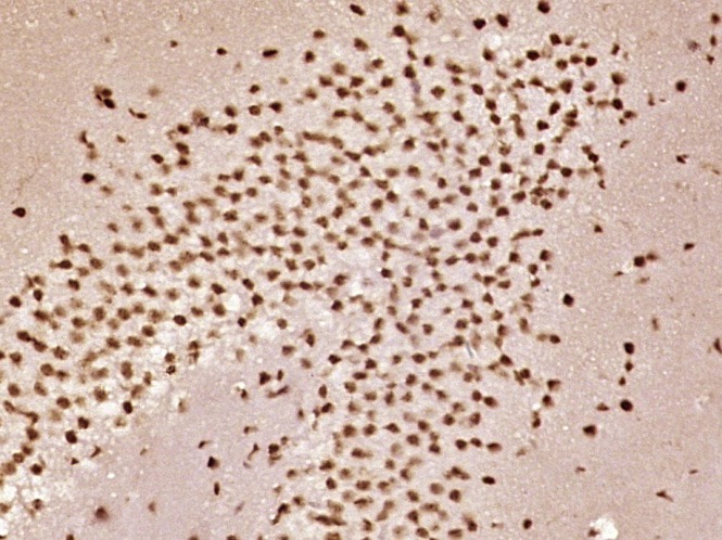 Anti-Phospho-Smad1/5 (Ser463, 465) Polyclonal Antibody