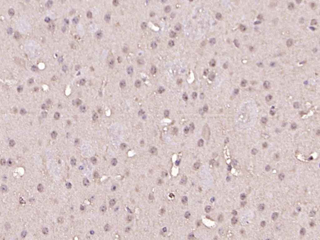 Anti-Phospho-Smad1/5 (Ser463, 465) Polyclonal Antibody