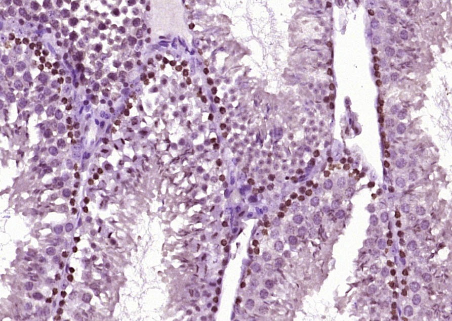 Anti-Phospho-Smad2 (Ser465, 467) Polyclonal Antibody