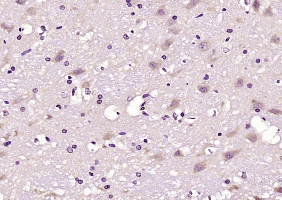 Anti-Phospho-LATS1 (Ser909) Polyclonal Antibody