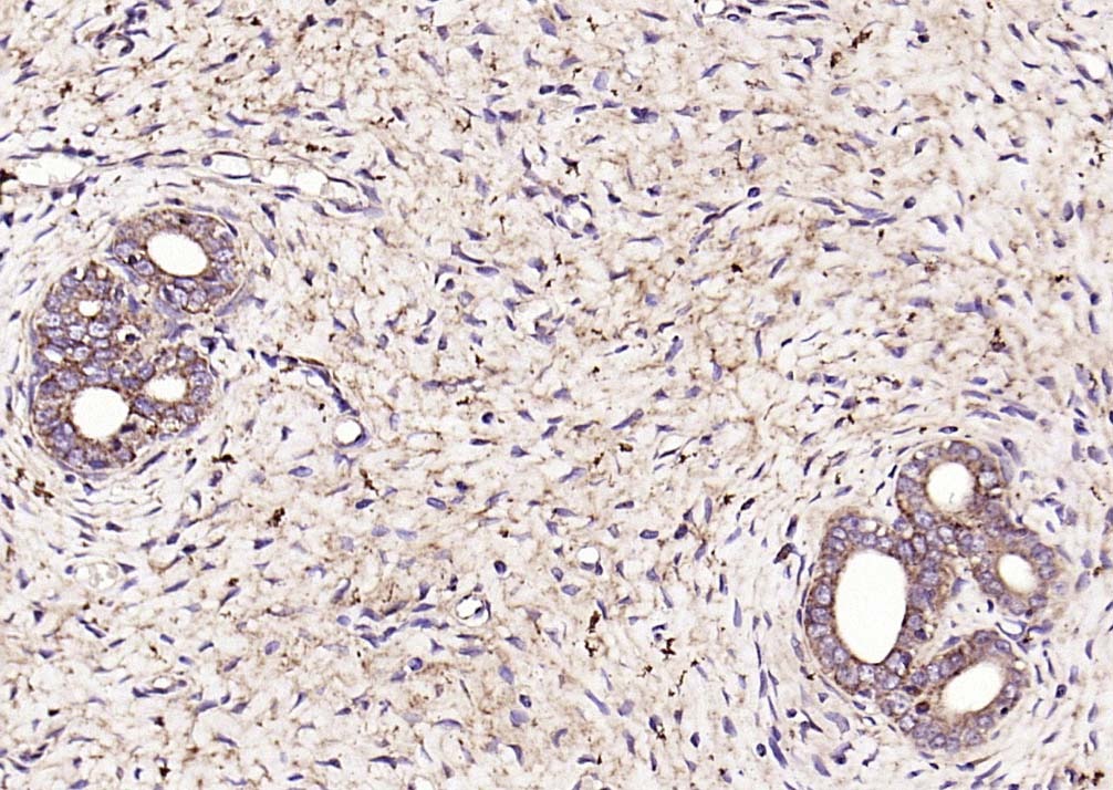 Anti-SOD2 Polyclonal Antibody 2