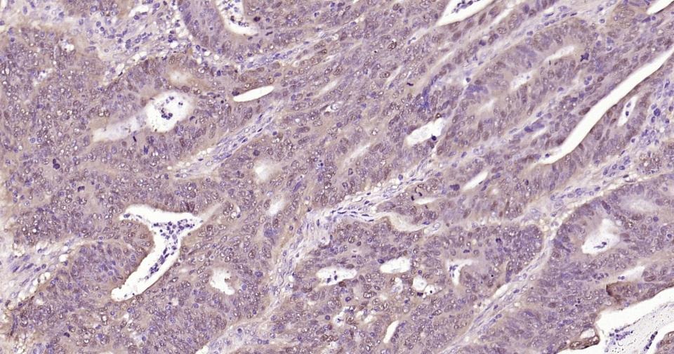 Anti-SNAI1 Polyclonal Antibody