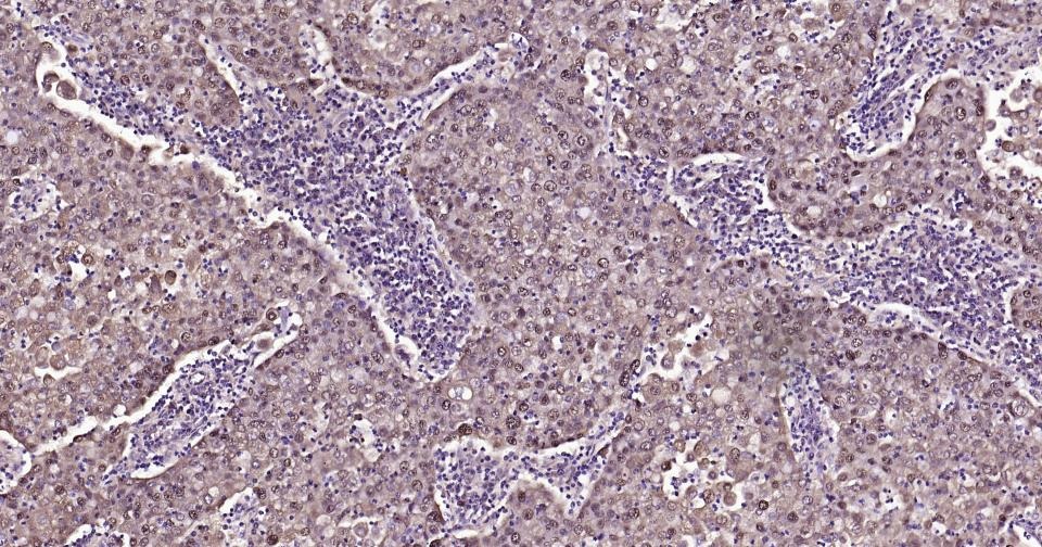 Anti-SNAI1 Polyclonal Antibody