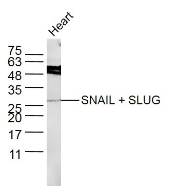 Anti-SNAIL + SLUG Polyclonal Antibody