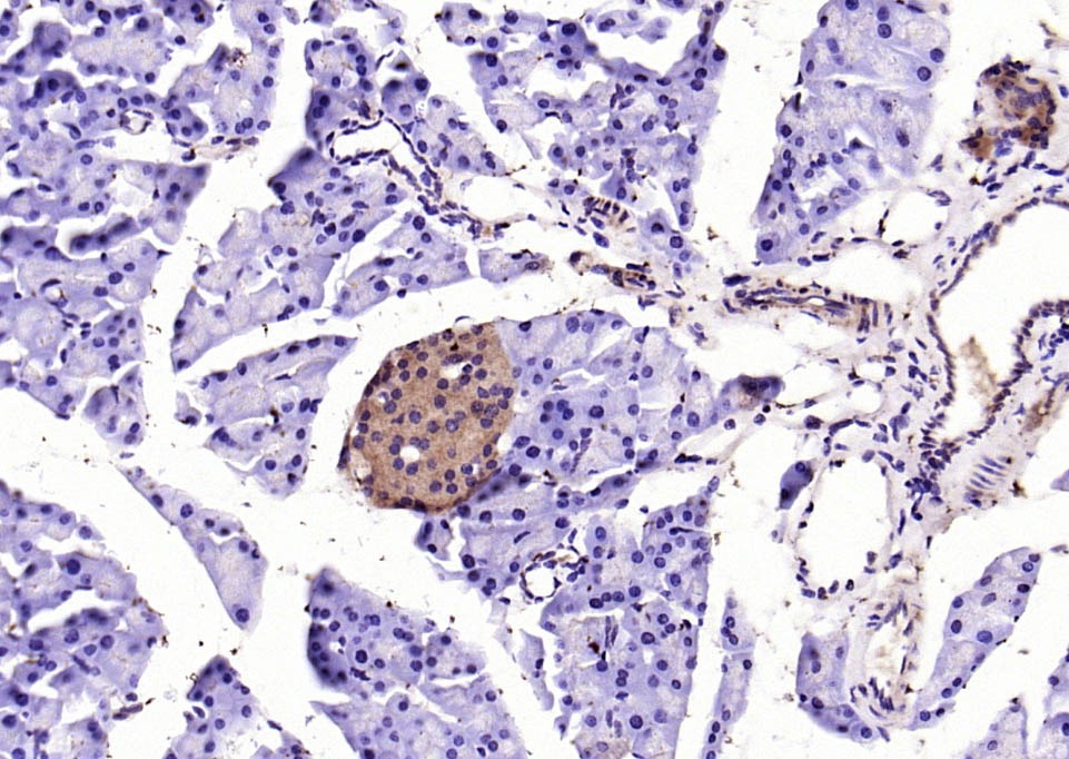 Anti-SOD2 Polyclonal Antibody 2