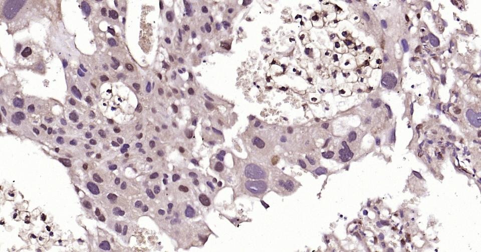 Anti-SNAI1 Polyclonal Antibody