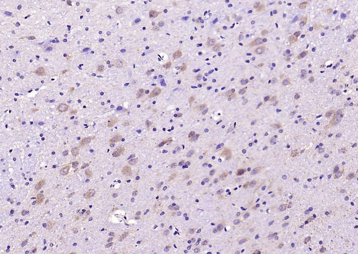Anti-SOD2 Polyclonal Antibody 2