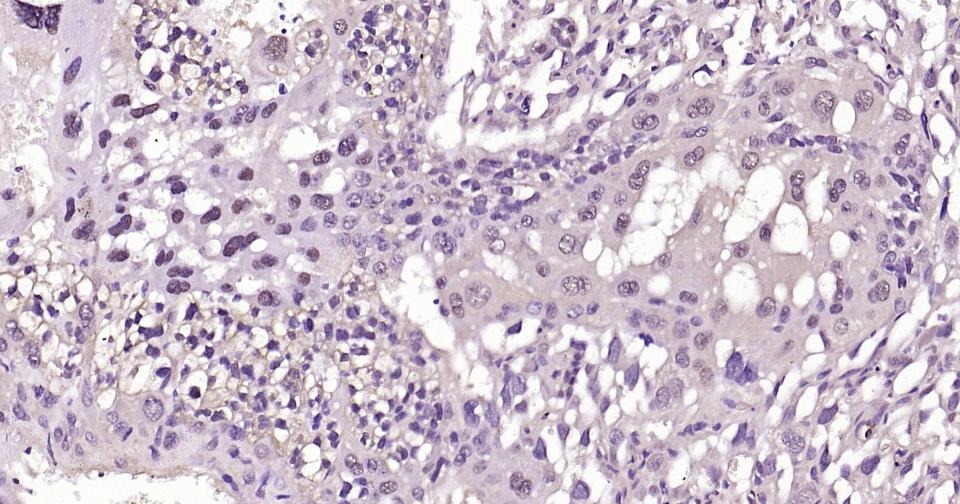 Anti-SNAI1 Polyclonal Antibody