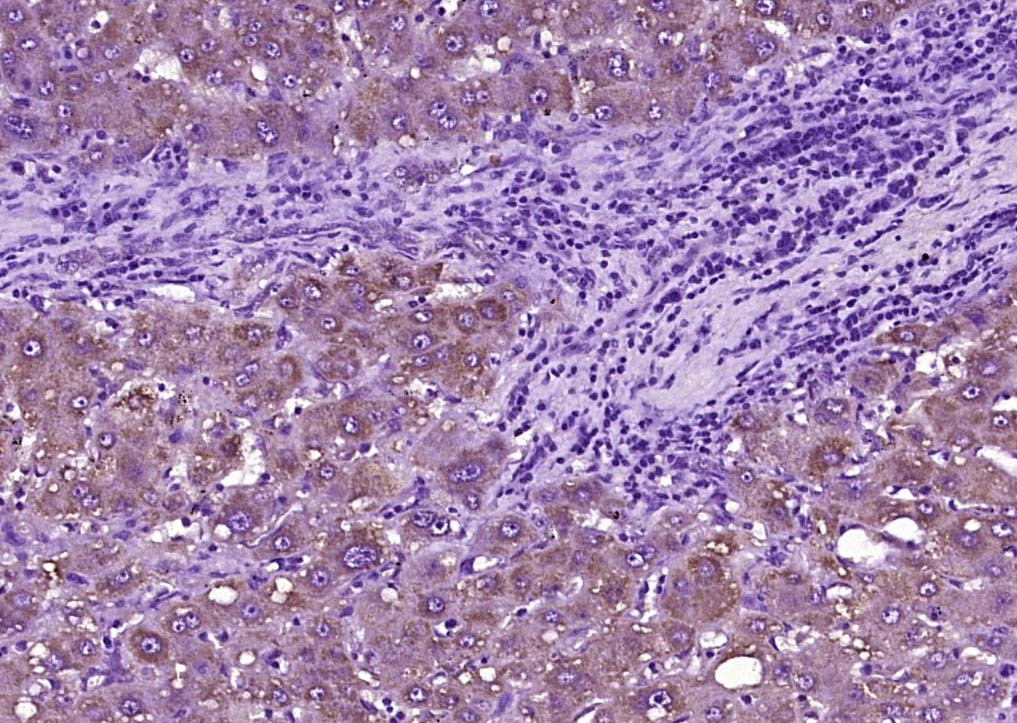 Anti-SOD2 Polyclonal Antibody 2