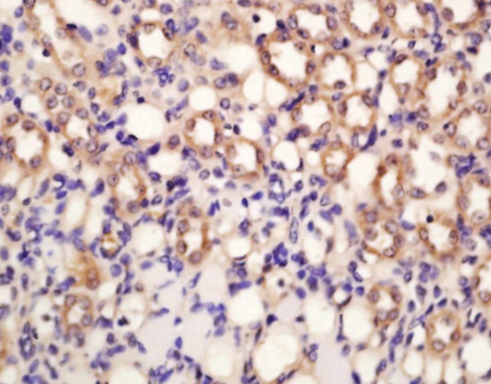 Anti-SOD1 Polyclonal Antibody