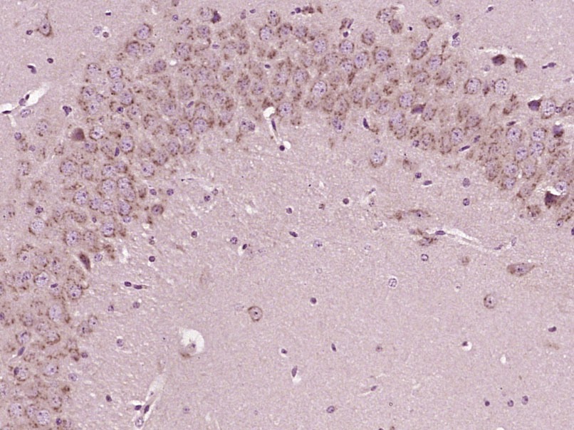 Anti-Sodium hydrogen exchanger 1 Polyclonal Antibody