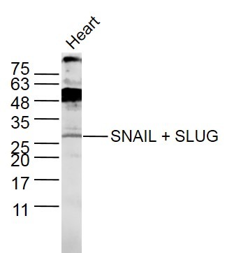 Anti-SNAIL + SLUG Polyclonal Antibody