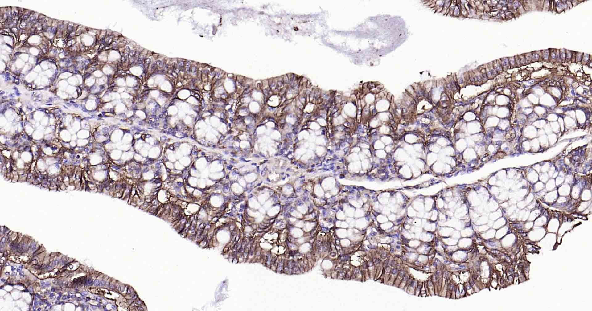 Anti-Sodium Potassium ATPase Antibody (8O42)