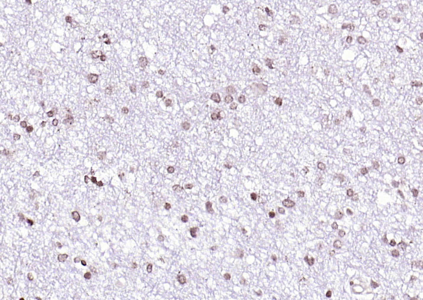 Anti-SOX4 Polyclonal Antibody
