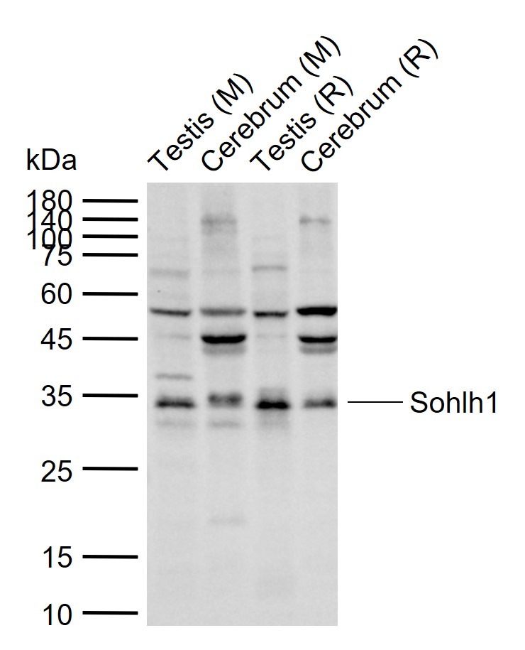 Anti-Sohlh1 Polyclonal Antibody