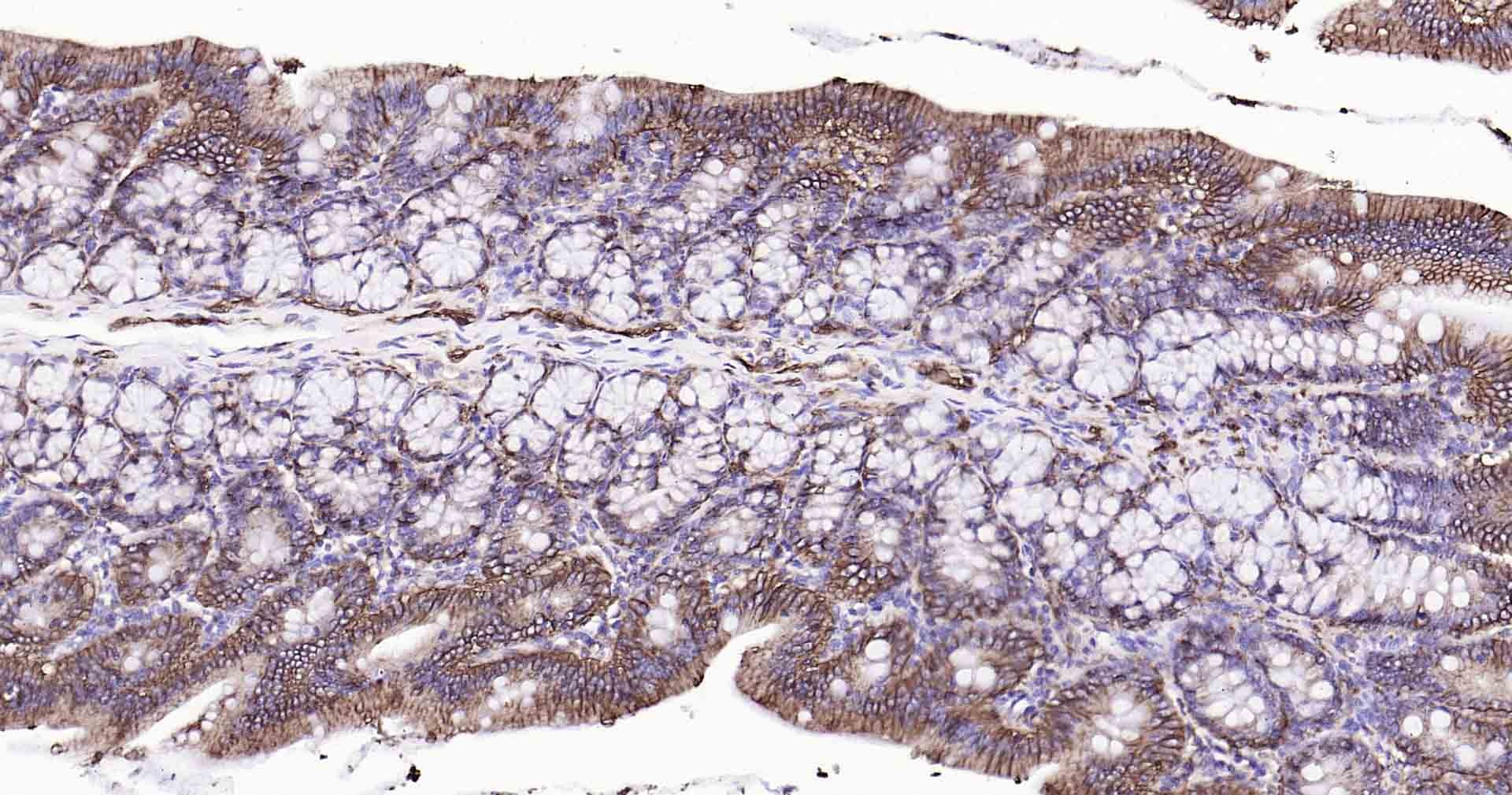 Anti-Sodium Potassium ATPase Antibody (8O42)