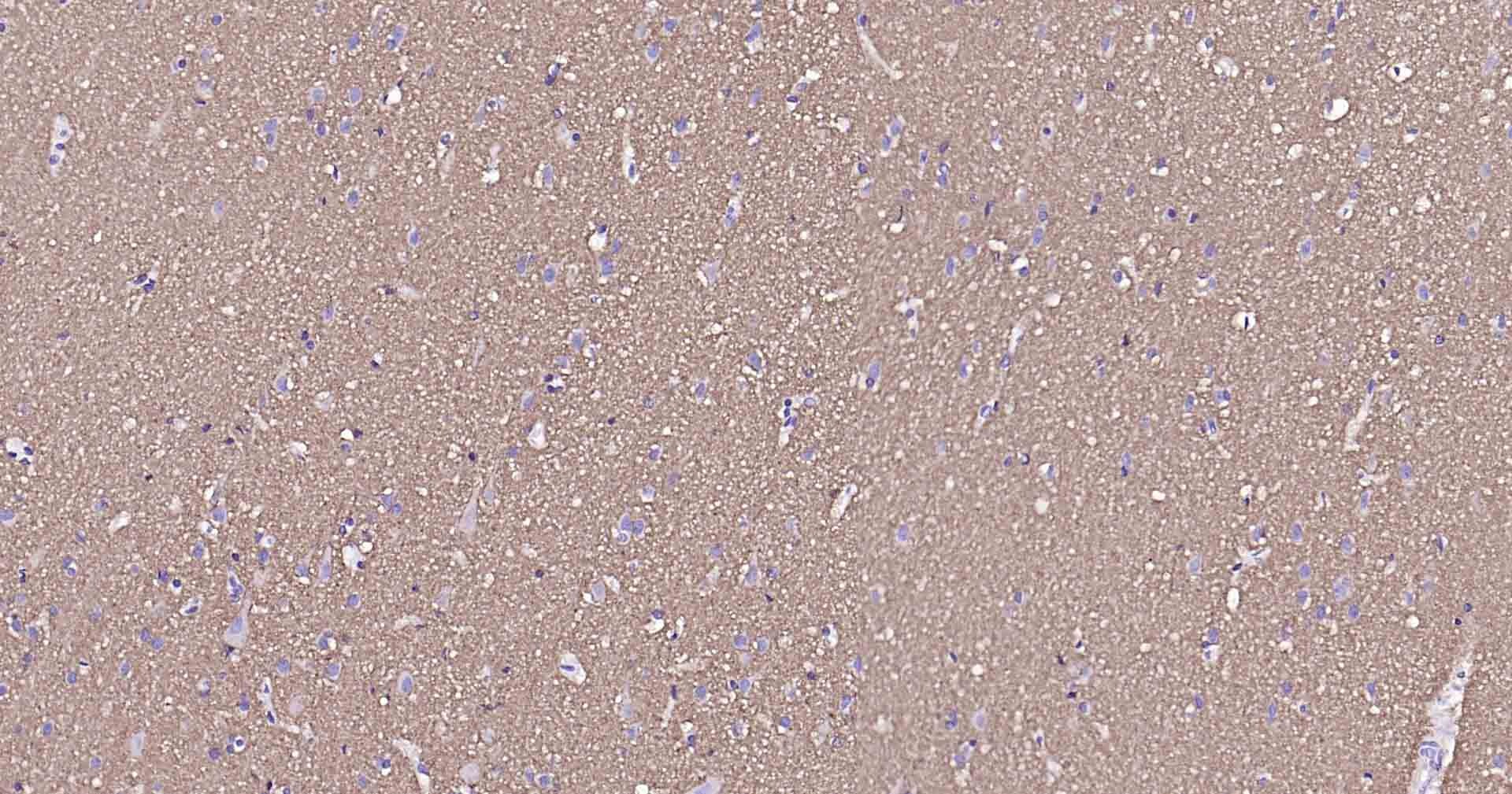 Anti-Sodium Potassium ATPase Antibody (8O42)