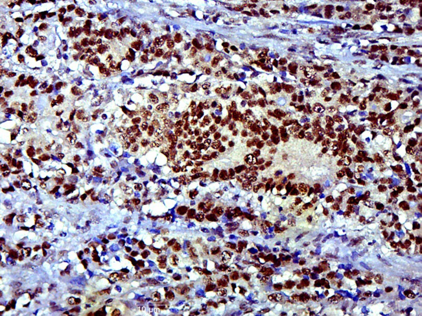 Anti-SOX9 Polyclonal Antibody