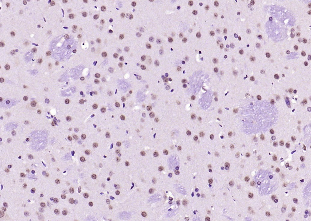 Anti-SOX9 Polyclonal Antibody 2