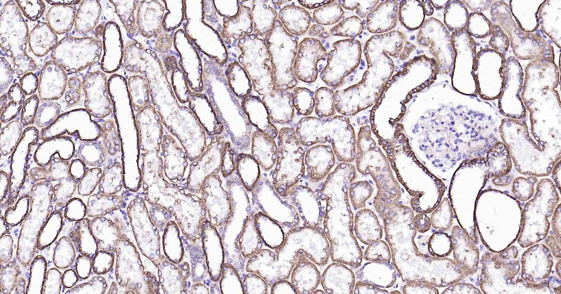 Anti-Sodium Potassium ATPase Antibody (8O42)