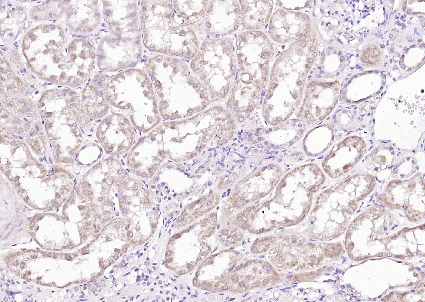 Anti-SOST Polyclonal Antibody