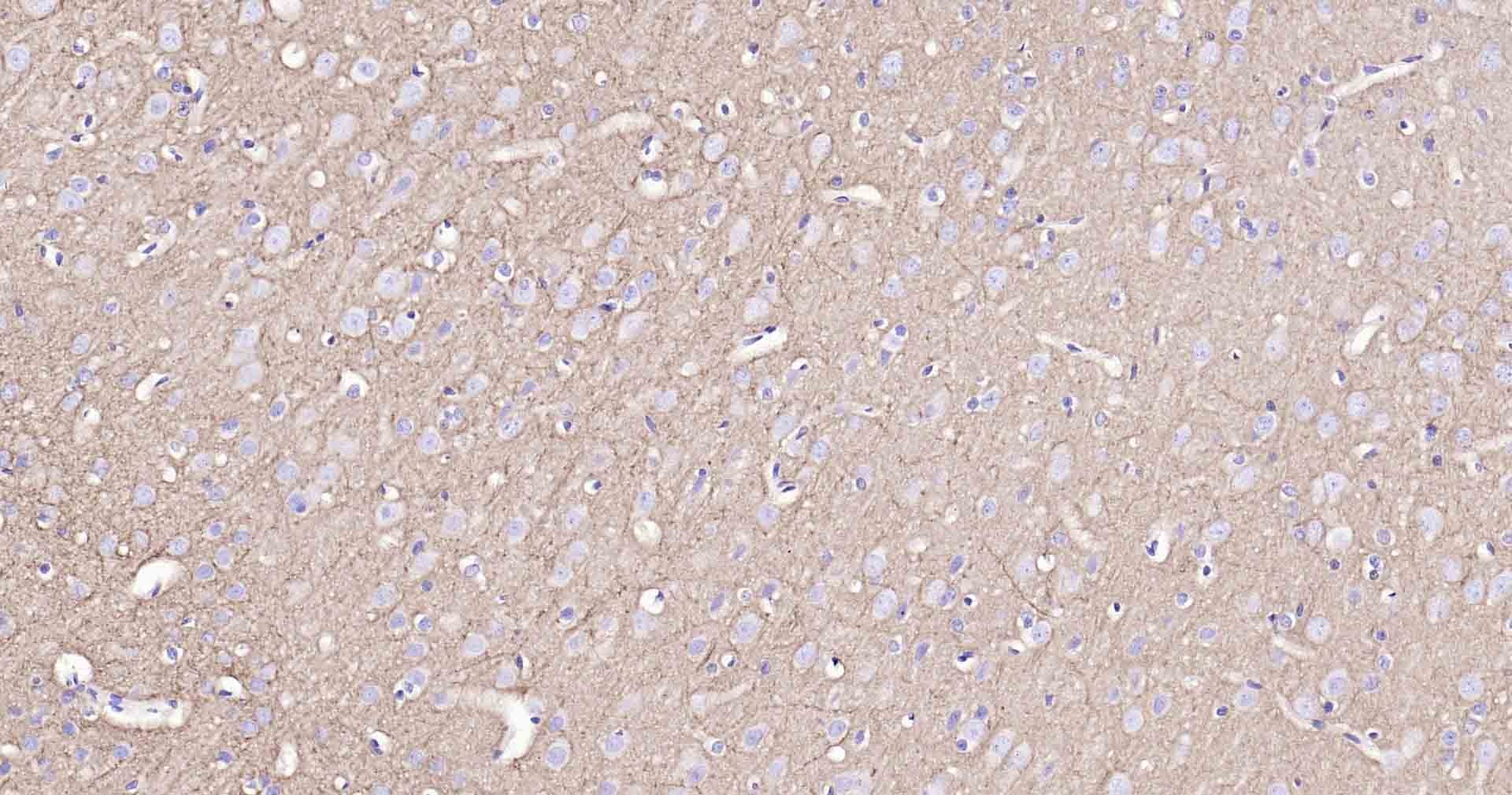 Anti-Sodium Potassium ATPase Antibody (8O42)