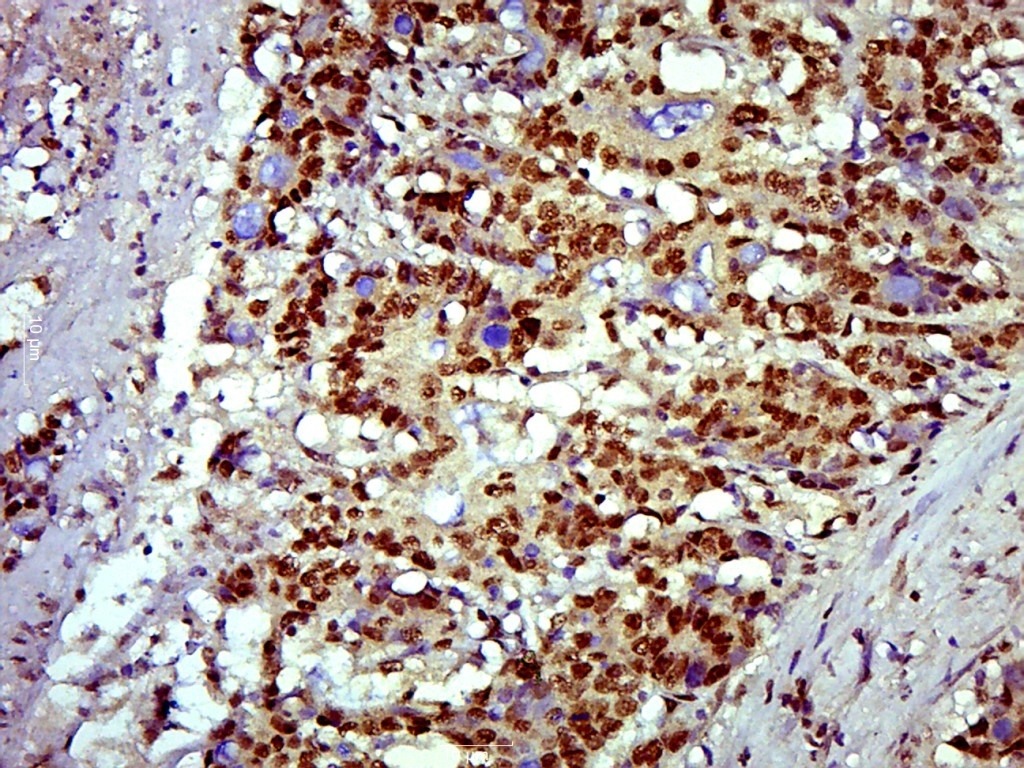 Anti-SOX9 Polyclonal Antibody 2