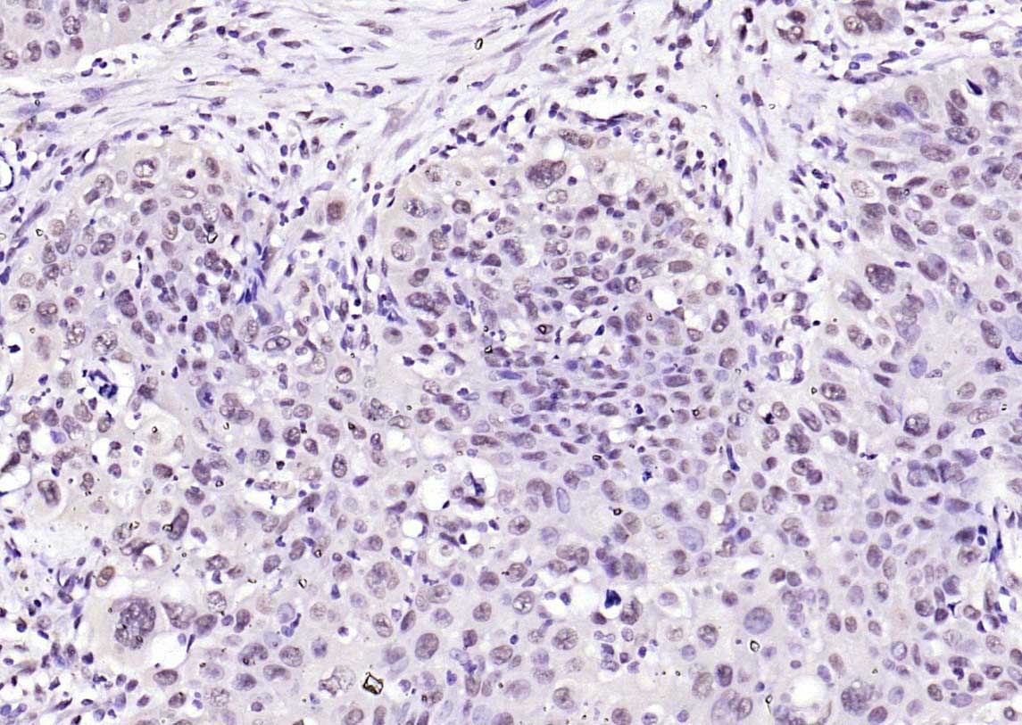 Anti-SOX9 Polyclonal Antibody 2