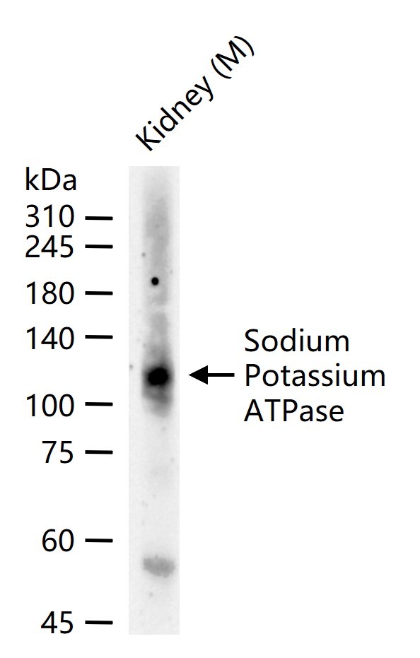 Anti-Sodium Potassium ATPase Antibody (8O42)