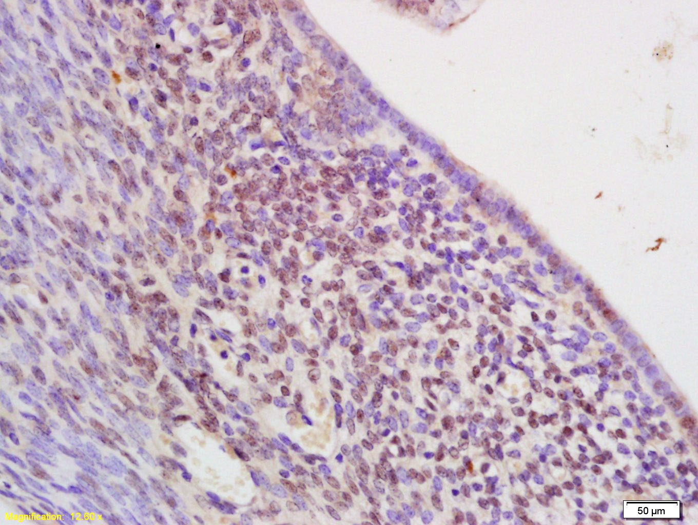 Anti-SOX17 Polyclonal Antibody