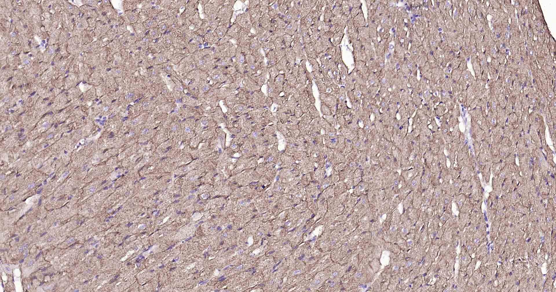 Anti-Sodium Potassium ATPase Antibody (8O42)