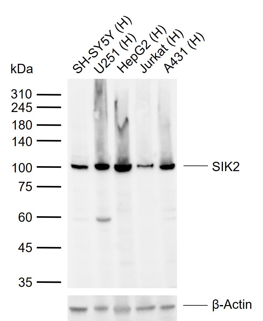 Anti-SIK2 Polyclonal Antibody