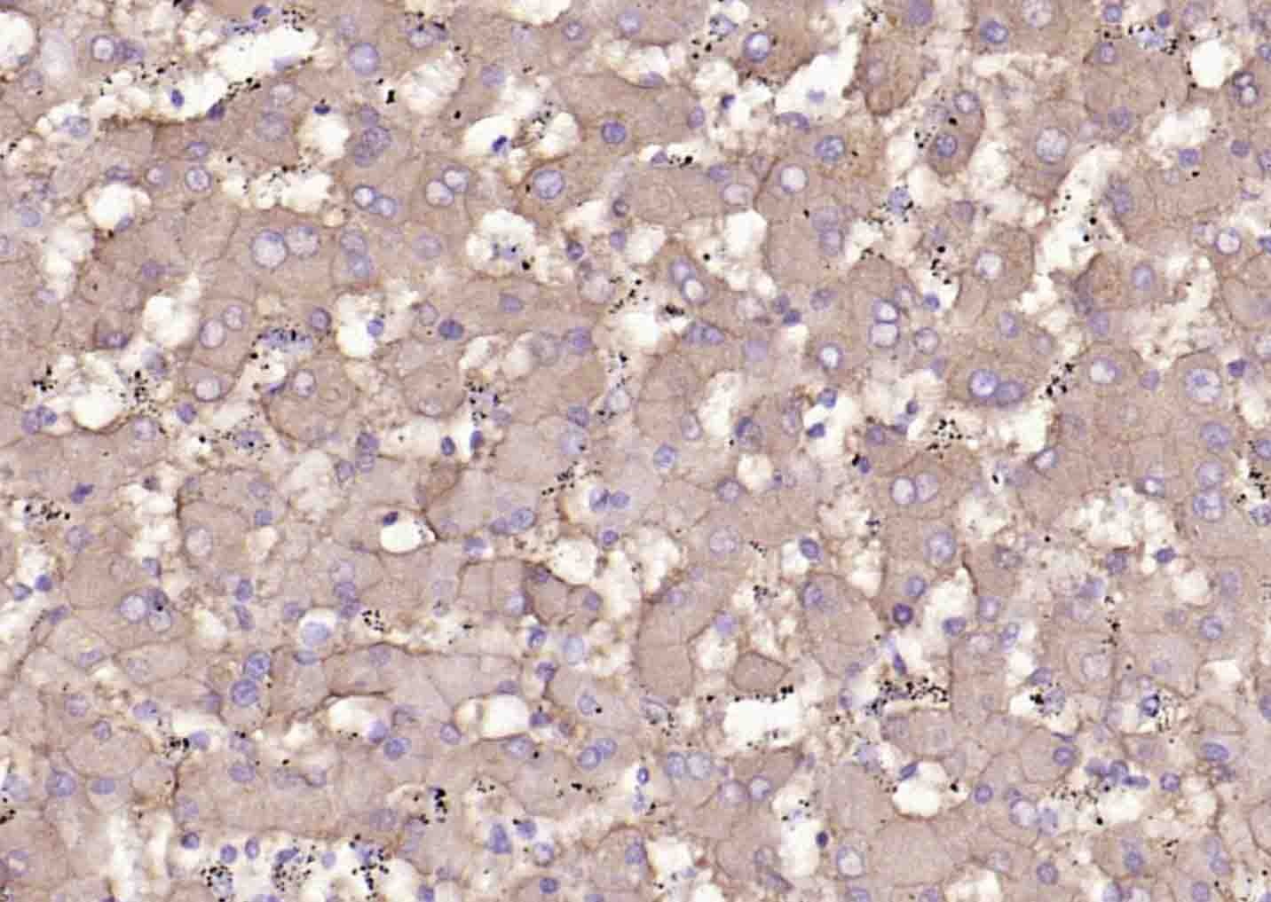 Anti-SLC39A14 Polyclonal Antibody