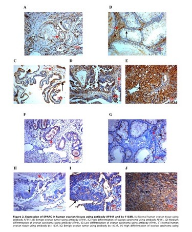 Anti-SPARC Polyclonal Antibody