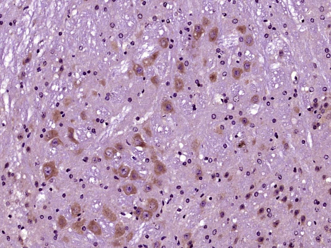Anti-SIRT1 Polyclonal Antibody 2