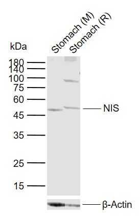Anti-SLC5A5 Polyclonal Antibody