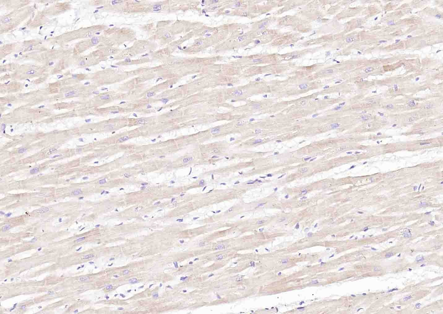 Anti-SLC39A14 Polyclonal Antibody