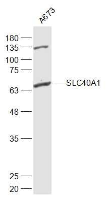 Anti-SLC40A1 Polyclonal Antibody 2