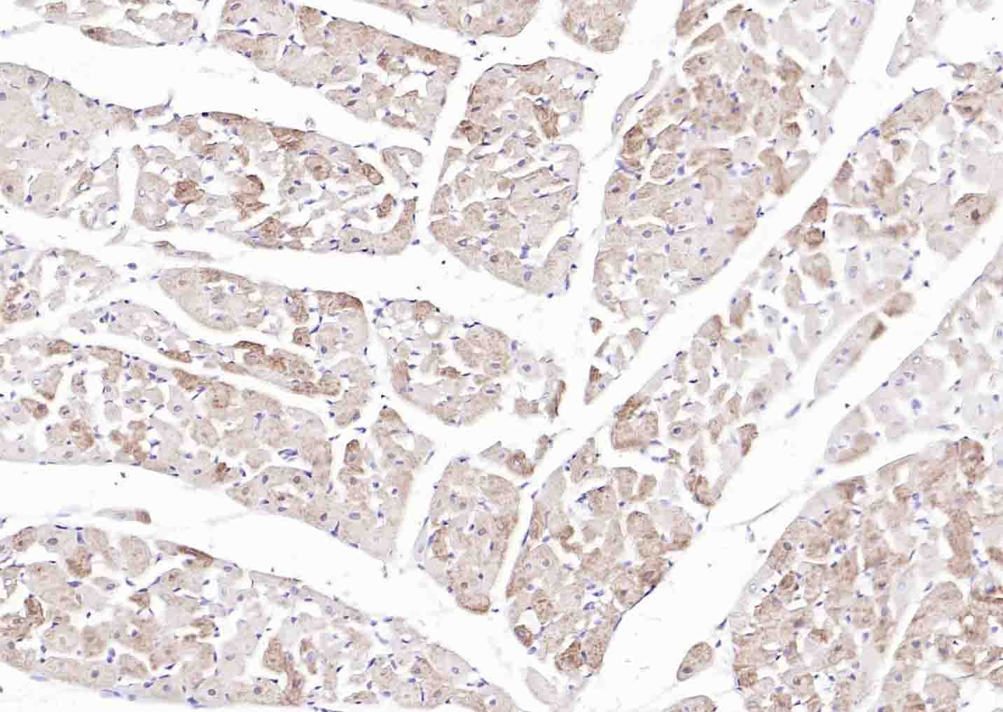 Anti-SLC39A14 Polyclonal Antibody